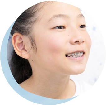小児矯正