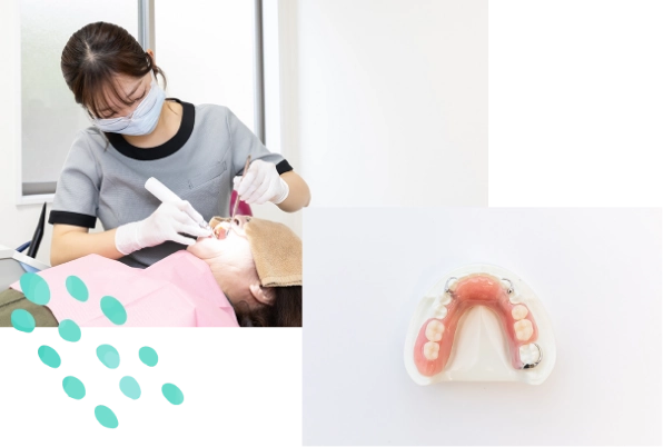 入れ歯治療