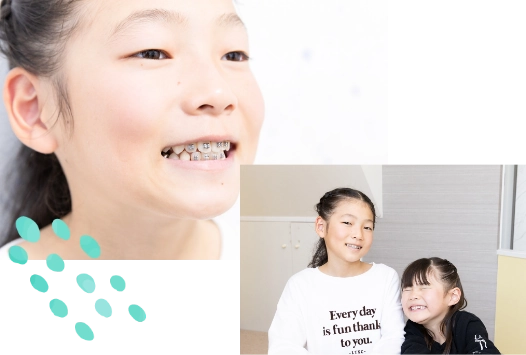 歯を抜かずに整える小児矯正