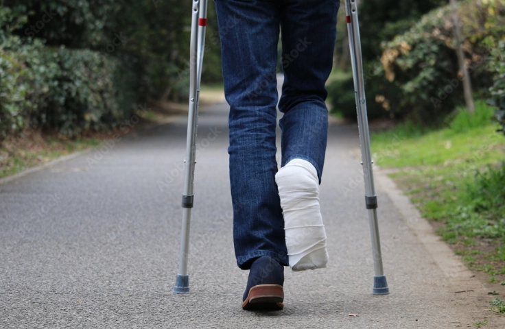 松葉杖のイメージ