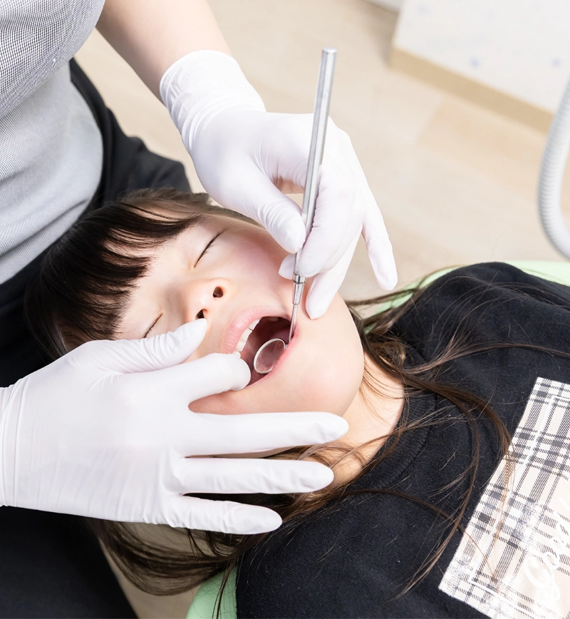 2回目：クリーニング＋むし歯の確認