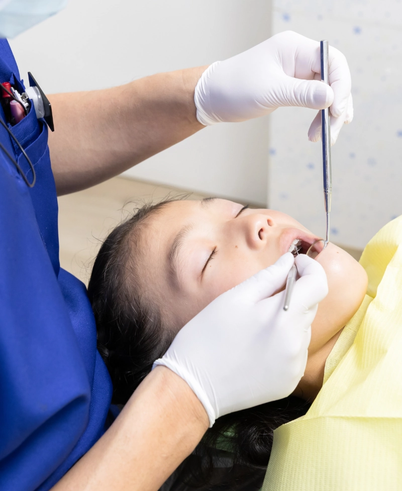 3回目：治療　※虫歯がある場合