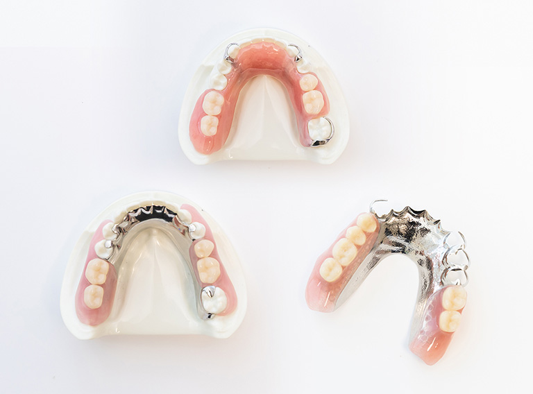 入れ歯（義歯）