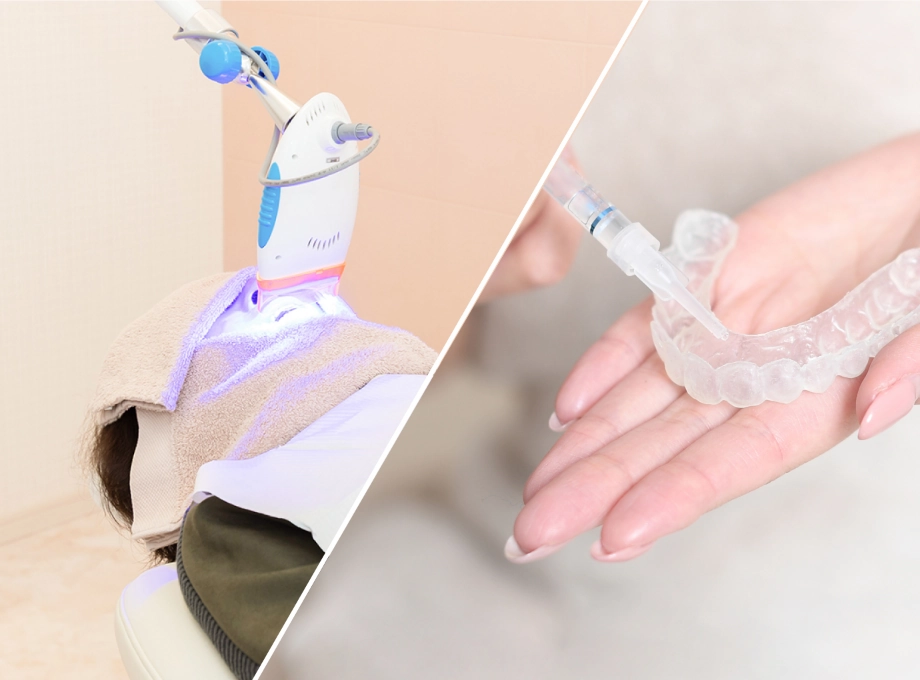 歯科＋ご自宅でのホワイトニング