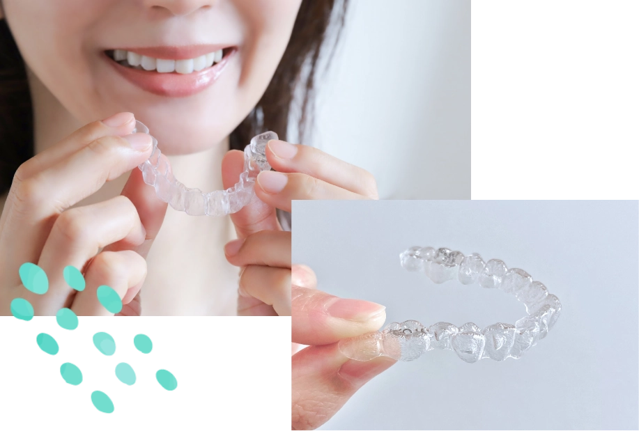 歯を抜きたくない方のための 矯正治療