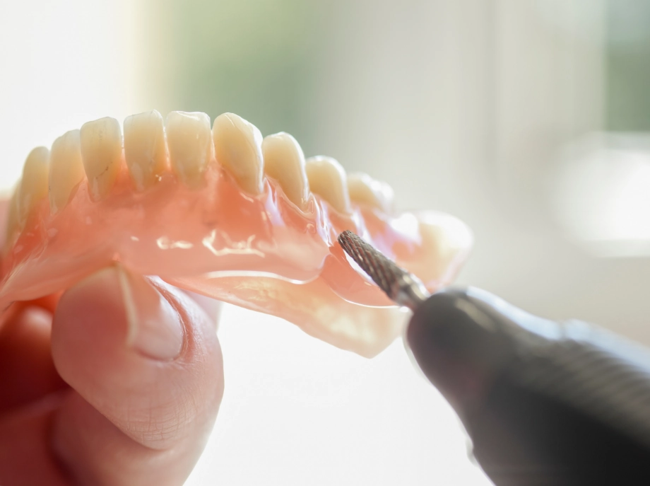入れ歯 修理・調整